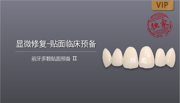 图片 前牙多颗贴面预备 Ⅱ