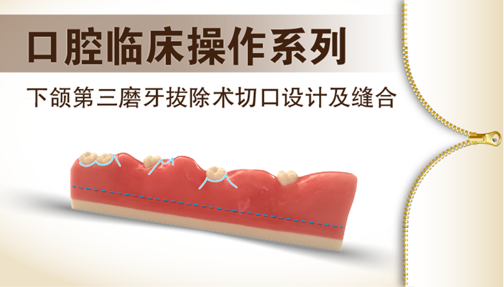 图片 下颌第三磨牙拔除术切口设计及缝合