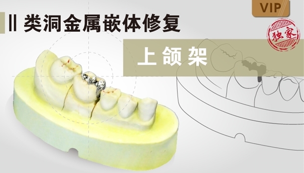 图片 上颌架