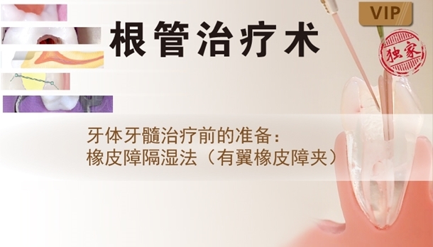 图片 牙体牙髓治疗前的准备：橡皮障隔湿法（有翼橡皮障夹）