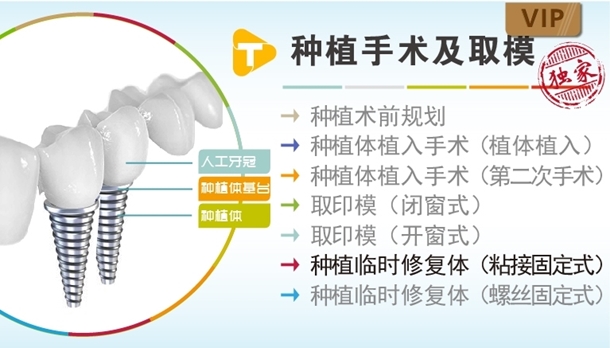 图片 种植临时修复体（粘接固定式）