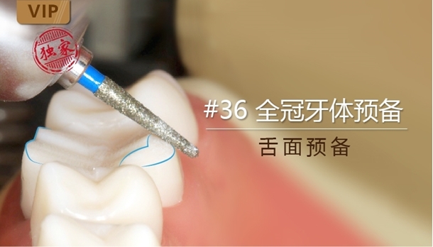 图片 舌面预备