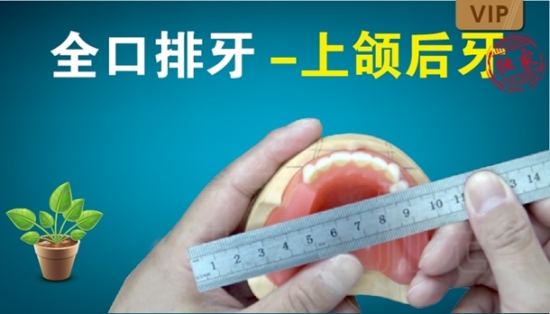 图片 全口排牙-上颌后牙