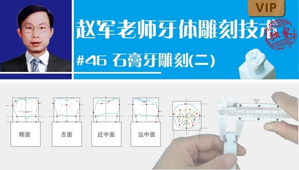 图片 牙体雕刻技术  #46石膏牙雕刻 （二）