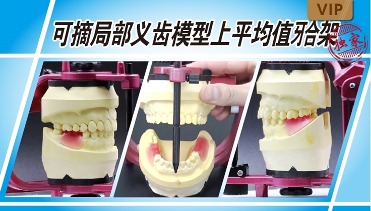 图片 可摘局部义齿模型上平均值颌架