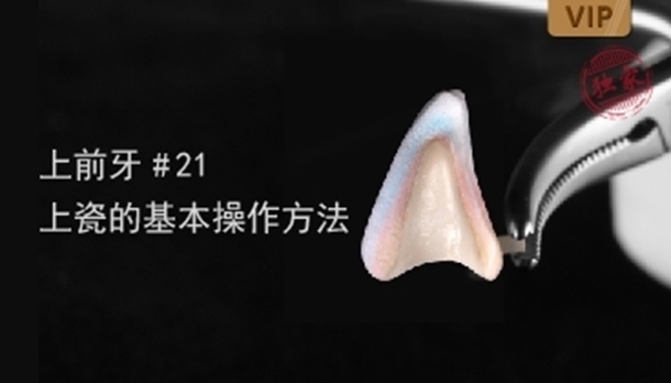 图片 上前牙#21 上瓷的基本操作方法
