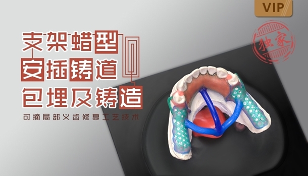 图片 可摘局部义齿修复工艺技术（六）