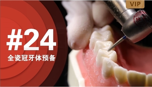 图片 #24全瓷冠牙体预备