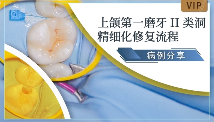 图片 上颌第一磨牙 II 类洞精细化修复流程